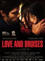 Love and bruises